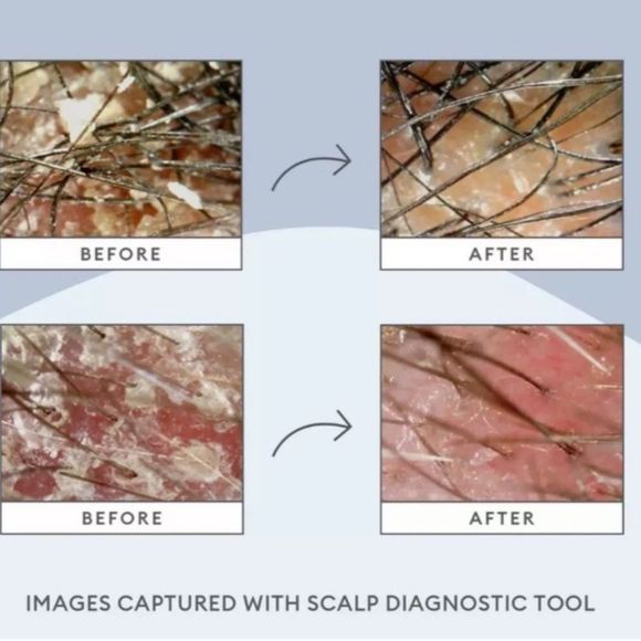 $7 🌙 Briogeo Scalp Revival Micro Exfoliating Shampoo NEW‎ - Picture 5 of 10